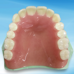 Complete Dentures